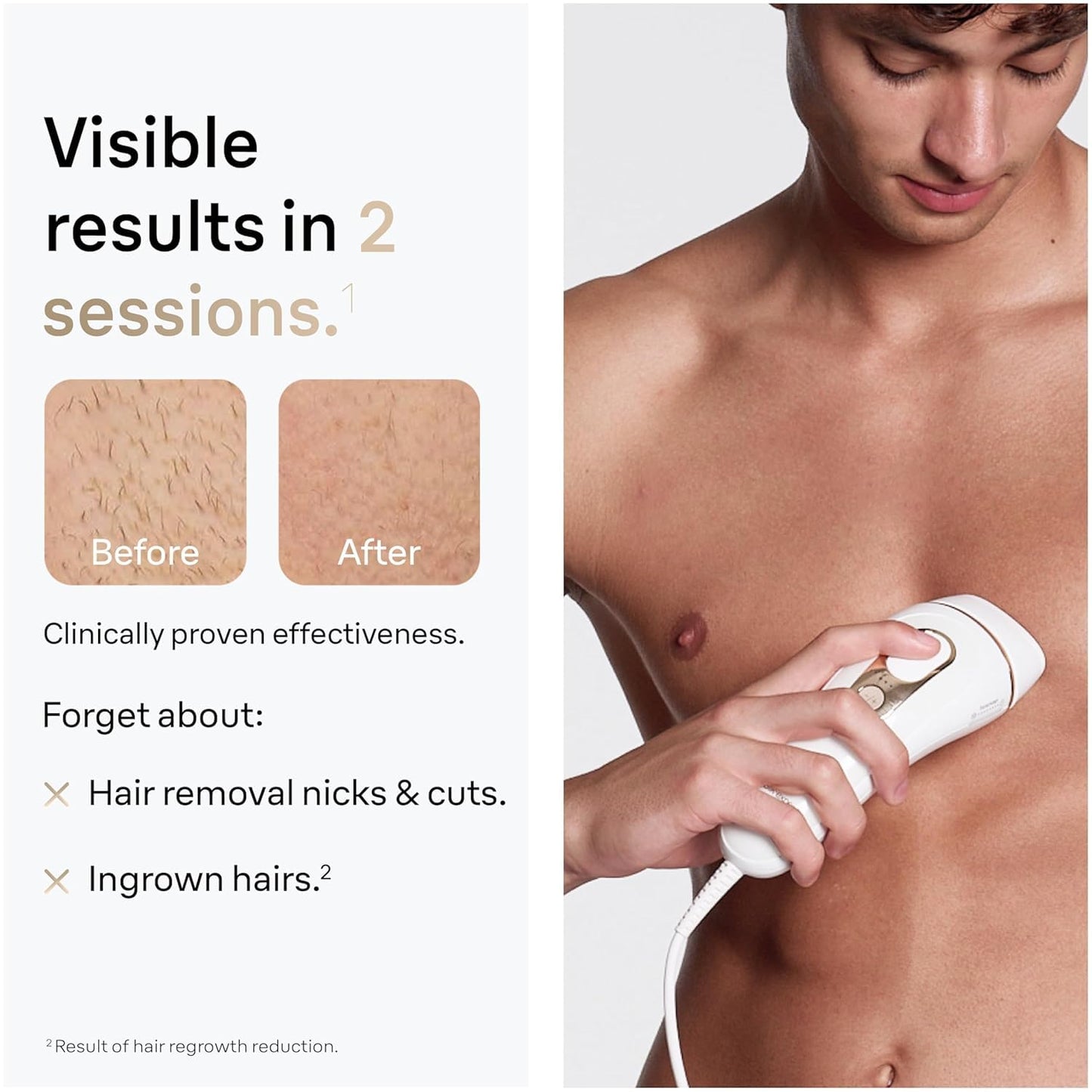 Braun IPL at Home Laser Hair Removal for Women and Men, Silk Expert Pro 5 PL5137 with Venus Swirl Razor, Permanent Visible Hair Reduction in Hair Regrowth for Body & Face, Corded, PL5137