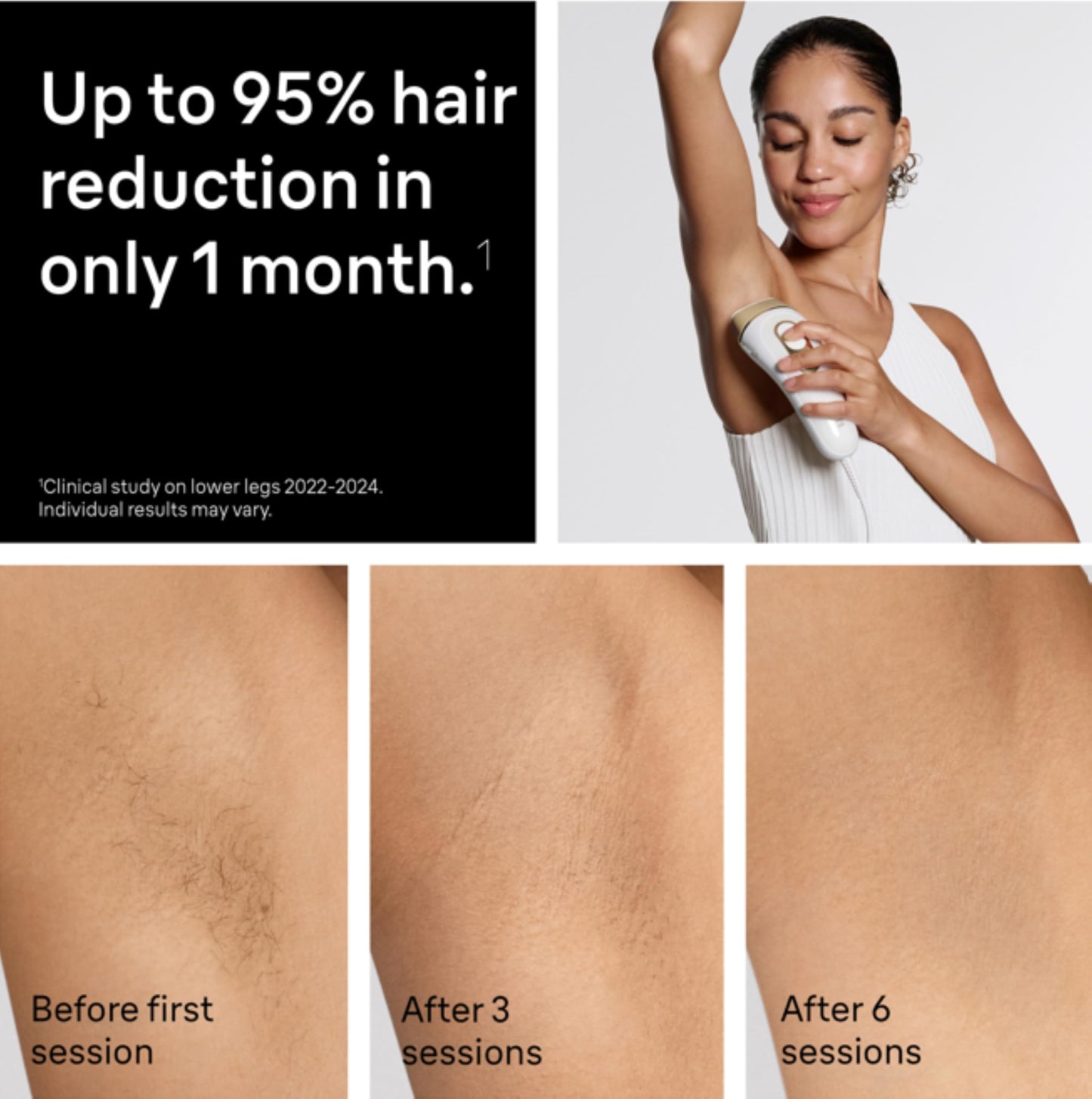 Braun IPL at Home Laser Hair Removal for Women and Men, Silk Expert Pro 5 PL5137 with Venus Swirl Razor, Permanent Visible Hair Reduction in Hair Regrowth for Body & Face, Corded, PL5137