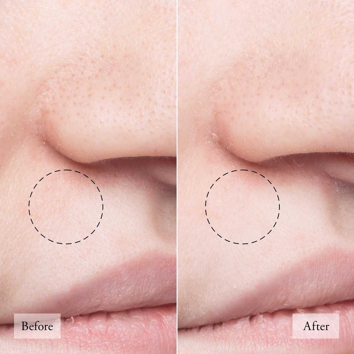 philosophy purity made simple one-step facial cleanser- with meadowfoam seed oil gently cleanses & melts away dirt, oil & stubborn makeup paraben-free face wash