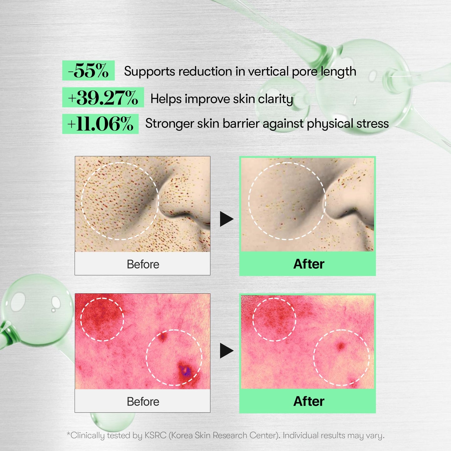 VT COSMETICS CICA Reedle Shot 100, Spicule Microneedling Serum for Pore Care & Exfoliation, Exosome, Centella Asiatica for Glass Skin, Skin Texture, Korean Liquid Skin Booster (1.69 Fl Oz / 50ml)